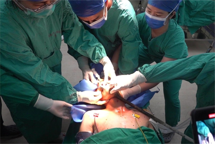 险！1.2米钢筋穿通男子颌面部，我院口腔颌面外科团队成功救治 第 2 张